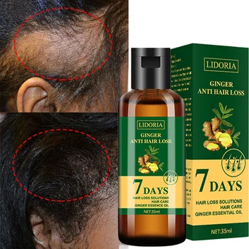 Aafrika Kiire Juuste Kasvu Õli Veojõukontroll Alopeetsia, Juuste Hõrenemine Ravi Seerumi Musta Õlid Anti Hair Loss Remonti Kahju Mehed, Naine